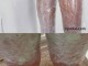 bodywrap