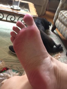 burgundy foot