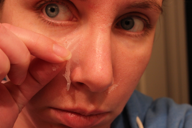 Can Elmer's Glue Remove Blackheads? Dermatologists Weigh In